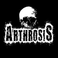 You are currently viewing ARTHROSIS